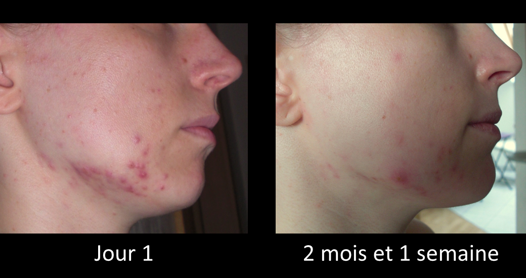 Does Your peptides musculation Goals Match Your Practices?