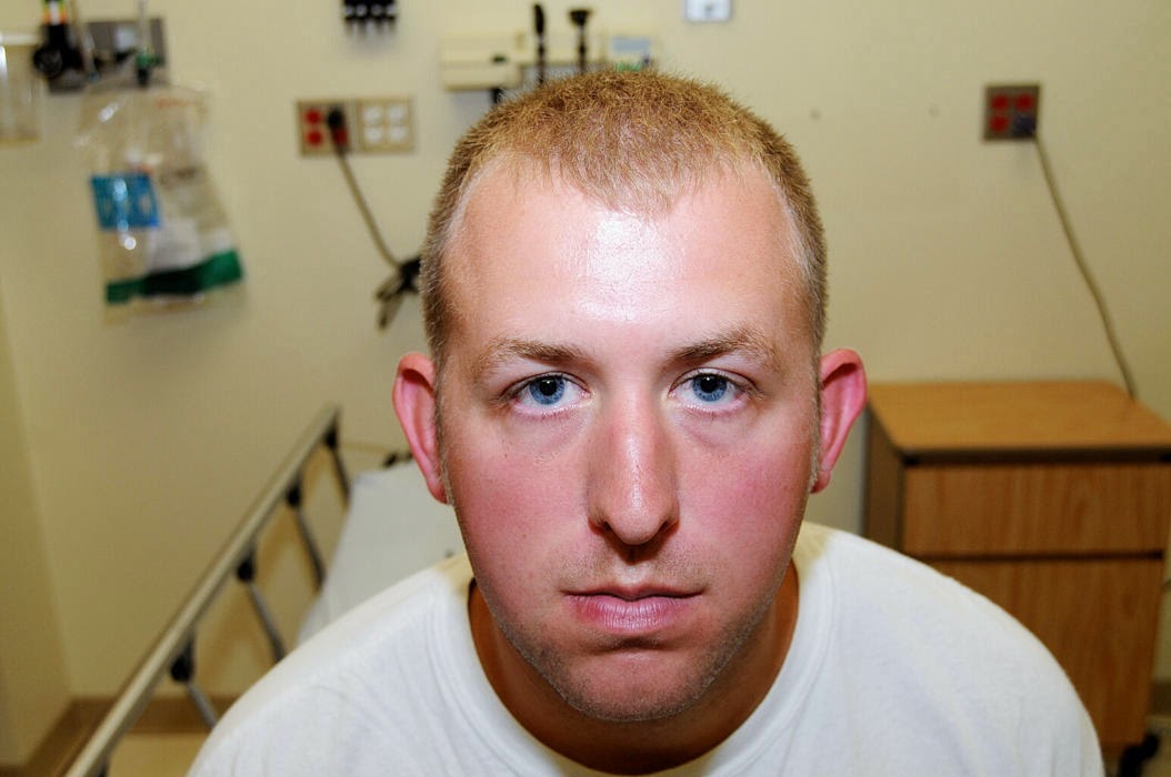 Target Liberty On Darren Wilson's "Broken Eye Socket"