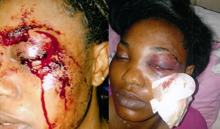 battered_woman+linda+ikeji+blog.jpg?width=234
