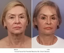 face before and after