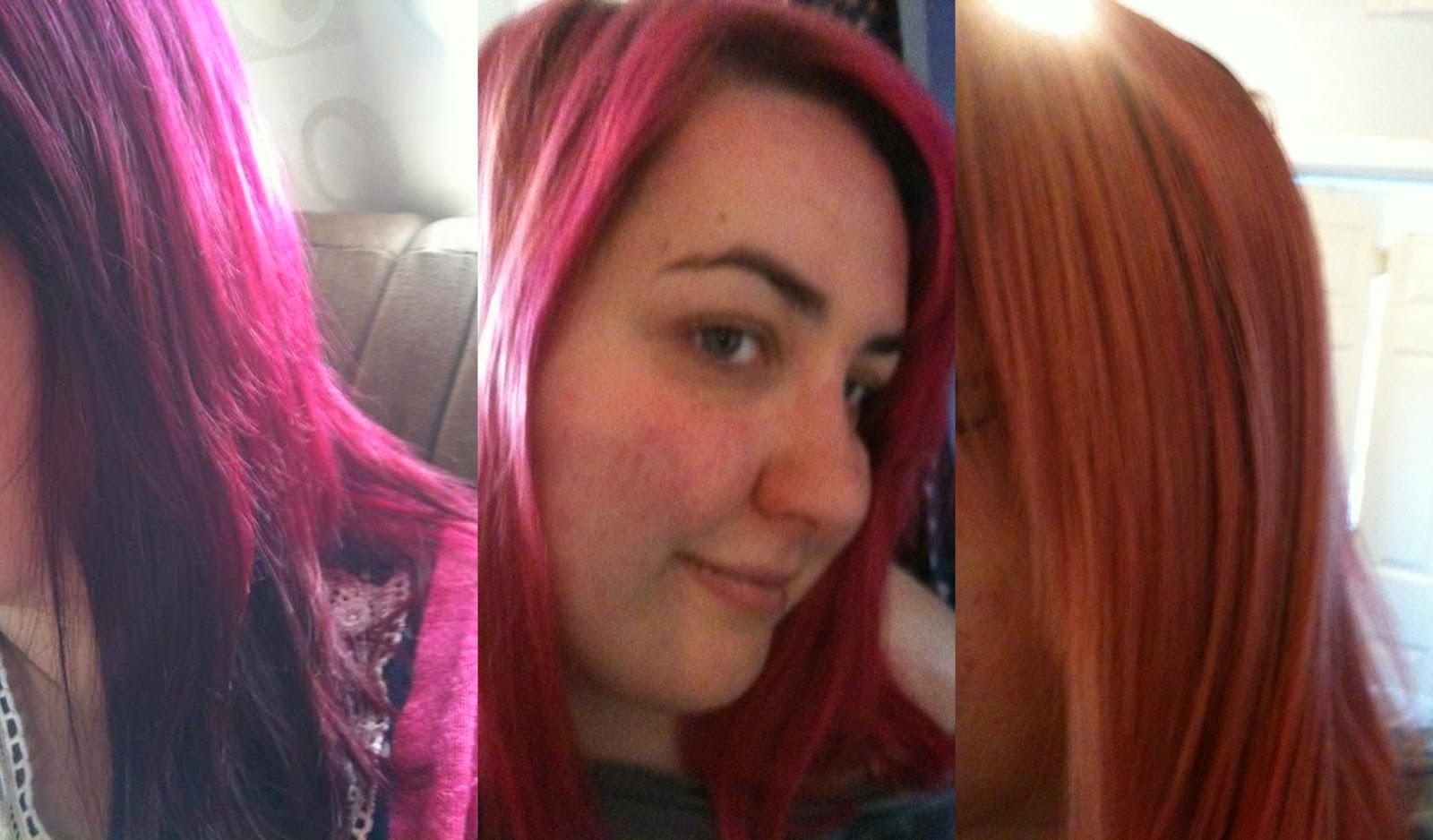 vitamins hair stripping taking been