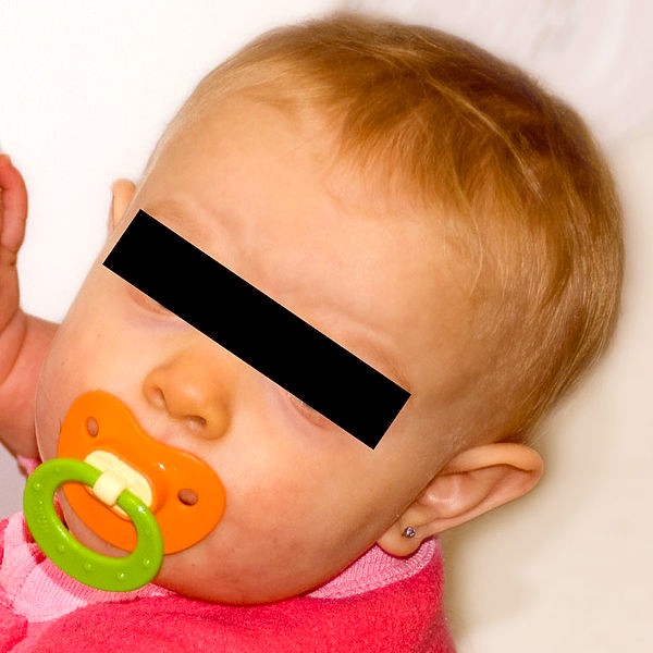 Carotene in carrots Orange skin discoloration the dynamic natural