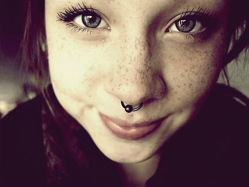 Freckles;