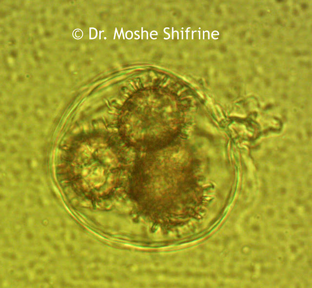Microsocpy image of Funghi spores.