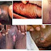 Obat Sipilis Paling Manjur Di Surabaya thumbnail