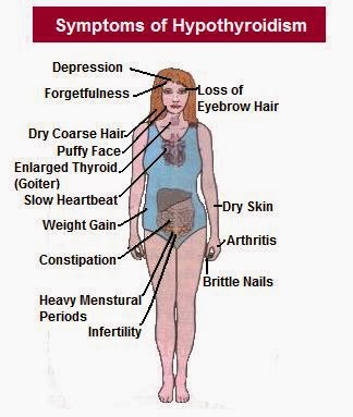 SIGNS & SYMPTOMS OF HYPOTHYROIDISM