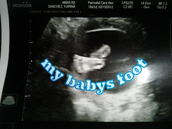 My Sons Foot :)