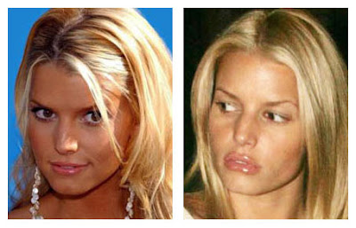 Jessica Simpson Plastic Surgery