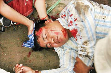 Bloodied Suong Sophorn after he was beaten by Hun Sen's cops in Sept. 21, 2011.