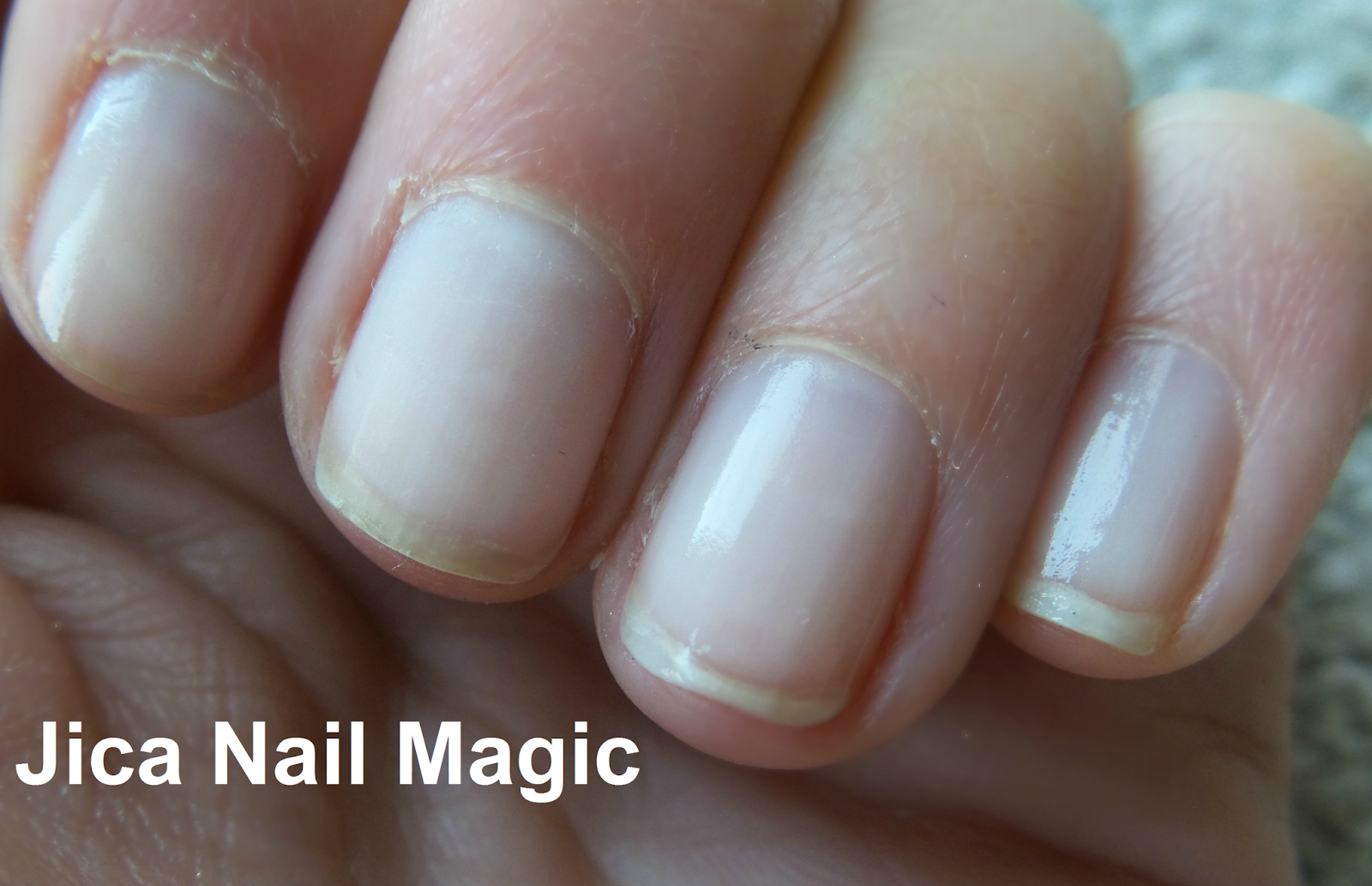 Nail Treatments For Damaged Nails Eltoria