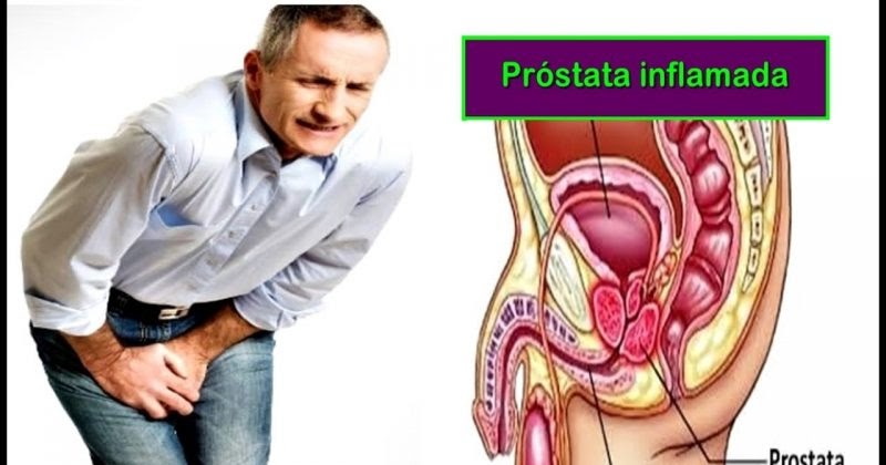 Cruel edging session with prostata