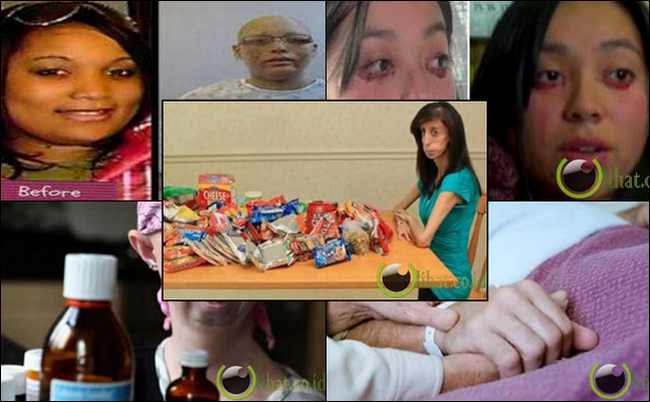 10 Orang dengan Kelainan Medis Teraneh di Dunia 10 Orang dengan Kelainan Medis Teraneh di Dunia