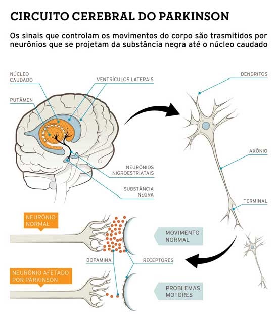 Biomedicina - Atualidades: CIRCUITO CEREBRAL DO PARKINSON