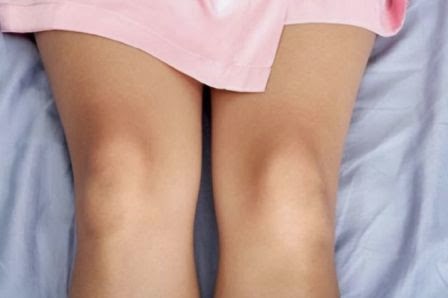 Waspadai Penyebab Lutut Dan Siku Menjadi Hitam Sebarkanlah Info
