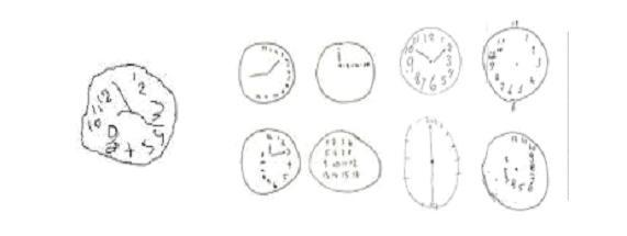 Clock Drawing Test