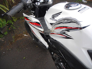 Pengalaman Kecelakaan Honda CB150R 