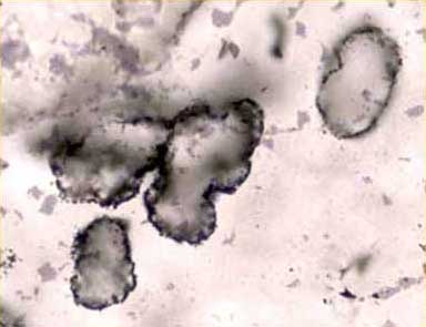 fossils-of-oldest-most-amazing-extinct-animals-oldest-fossil-found-in-australia fossils-of-oldest-most-amazing-extinct-animals-oldest-fossil-found-in-australia