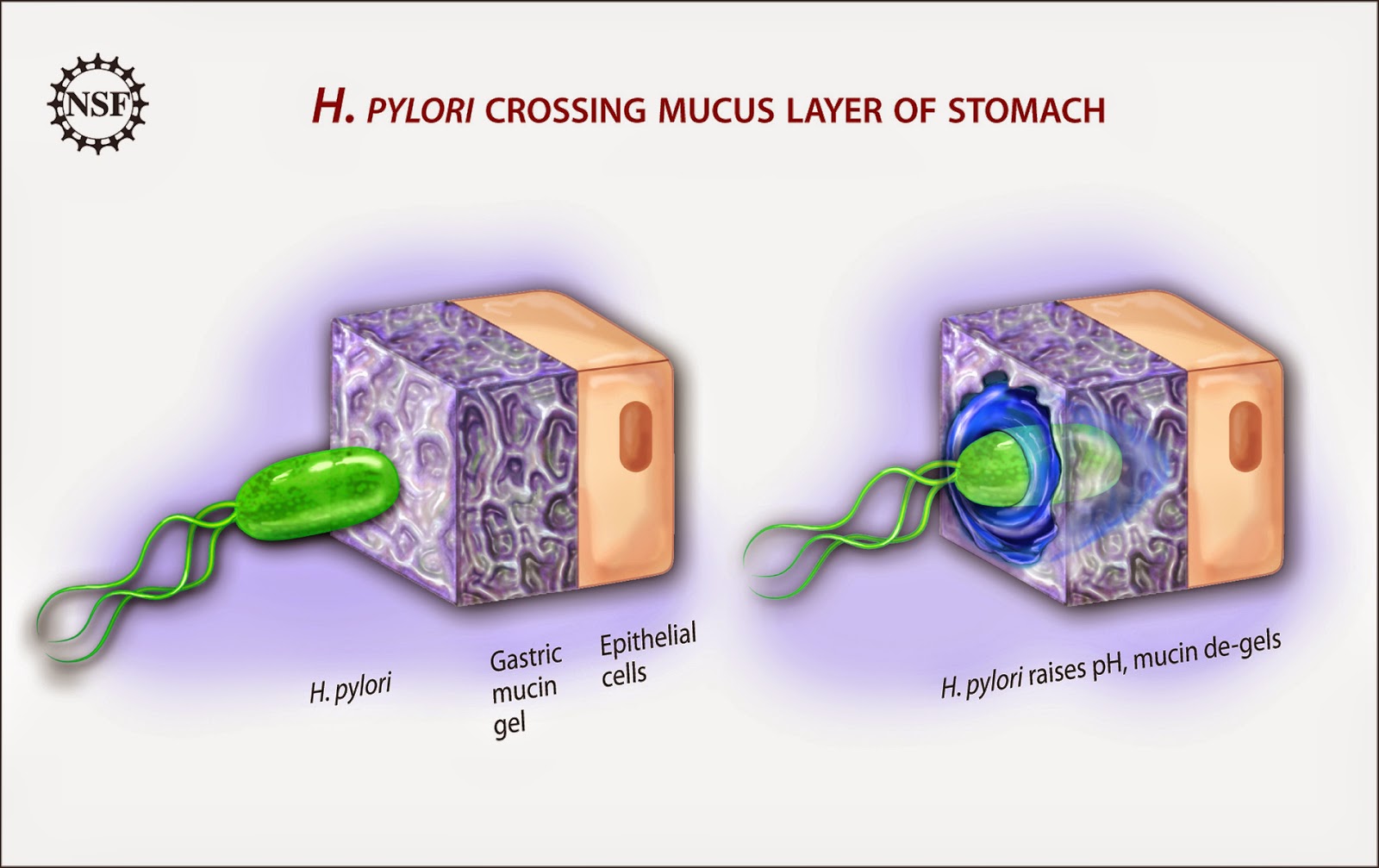 Trailing Normal Helicobacter pylori