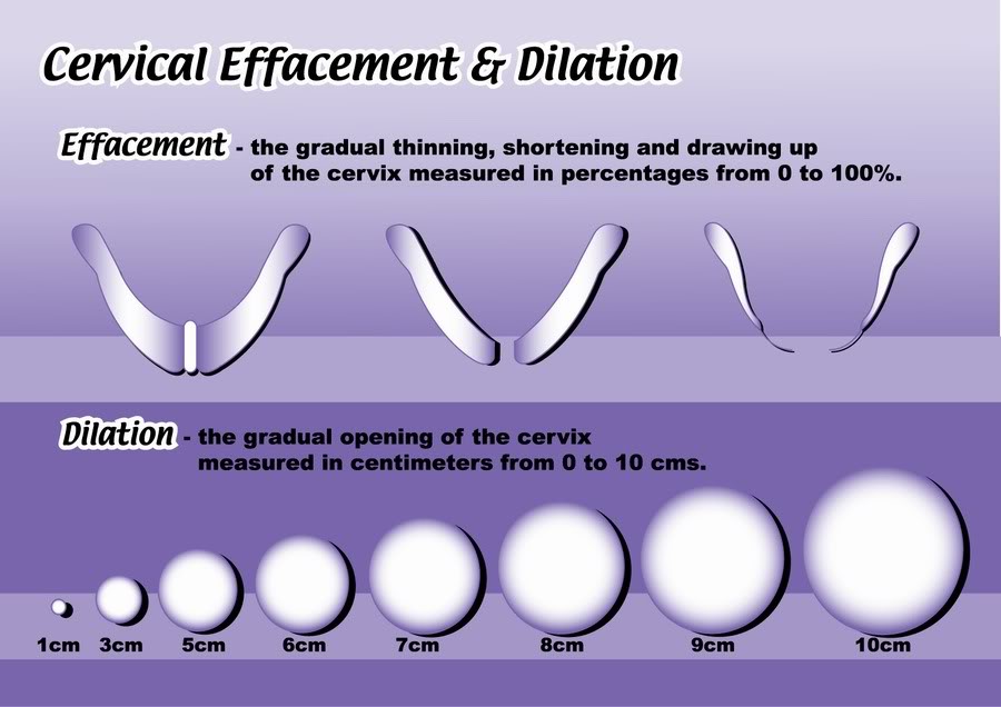 Centimeters Dilated Chart