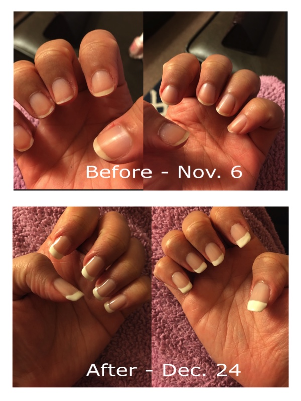 My Nail Growth Journey and the Best Tips and Tricks for Treating Your Nails