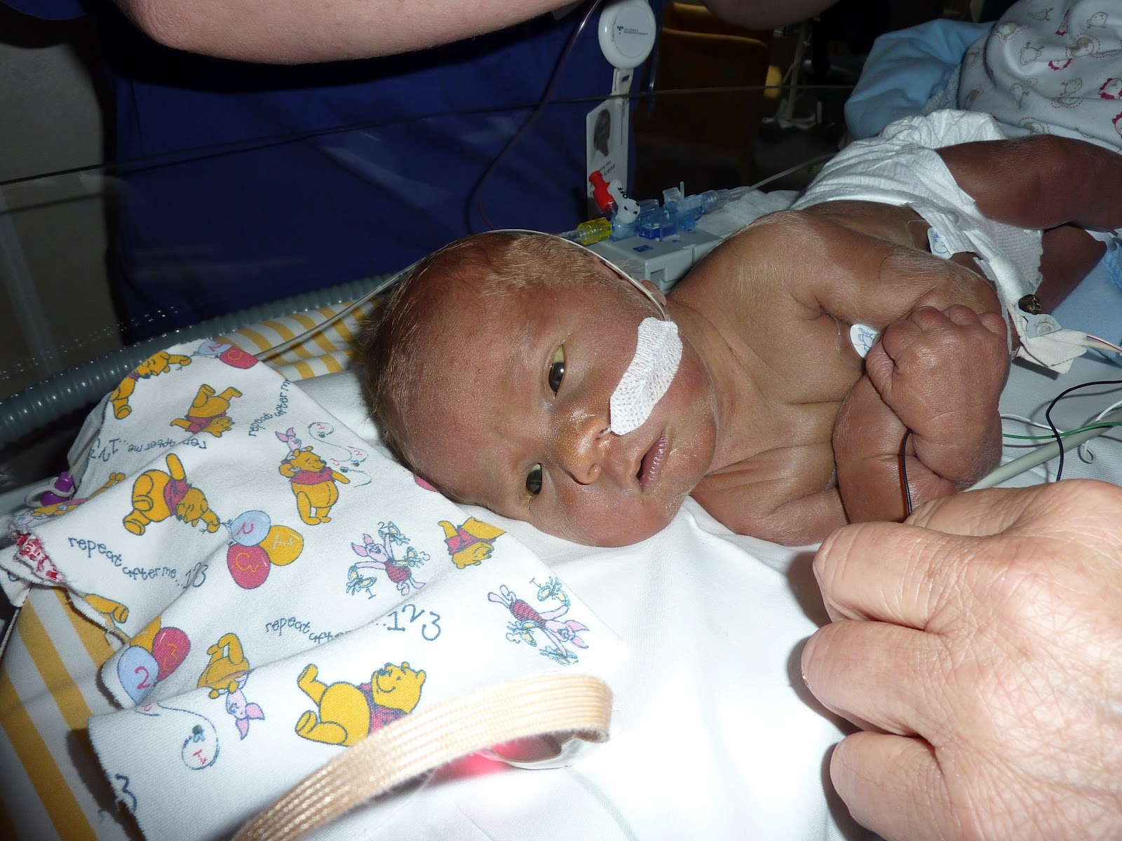 Godingen Gustav Bakgrund Hörselskadan Auditiv neuropati