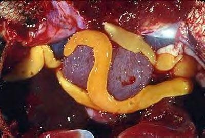 Platyhelminthes: Class Cestoda