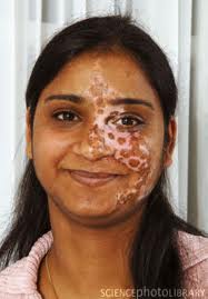 Expert Solutions Tips And Advice For Young Indians India Role