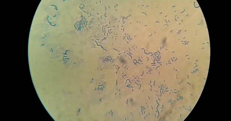 Proyecto Biología Rosa López PRÁCTICA 9OBSERVACIÓN DE LAS BACTERIAS