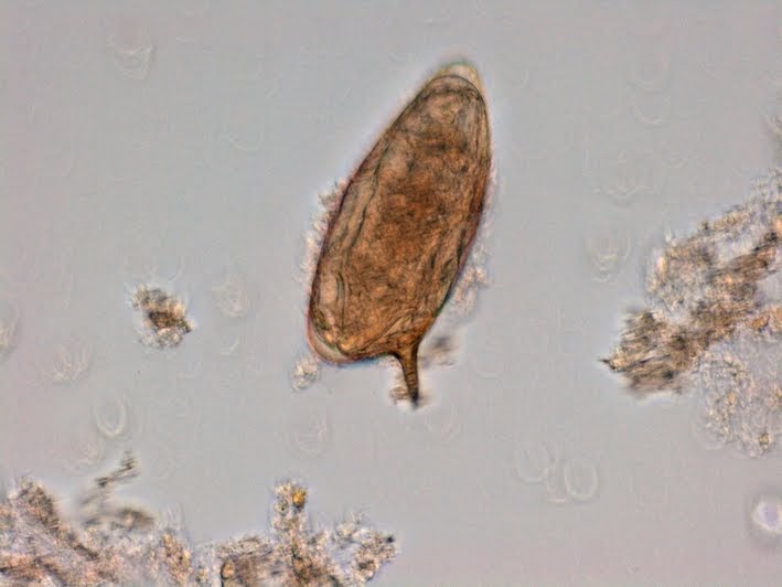 Fun With Microbiology (What's Buggin' You?) Schistosoma