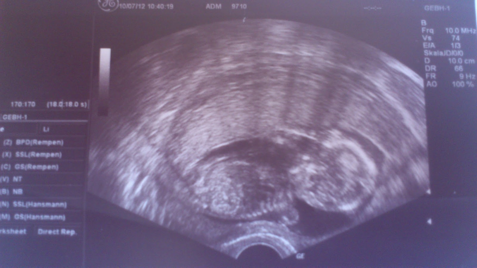 The Magical Cycle 2007