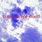 Pneumonia 100x microscope image