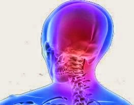 Αυχενογενής πονοκέφαλος   Πονοκέφαλος στην βάση του κρανίου... Αιτίες Συμπτώματα και αντιμετώπιση