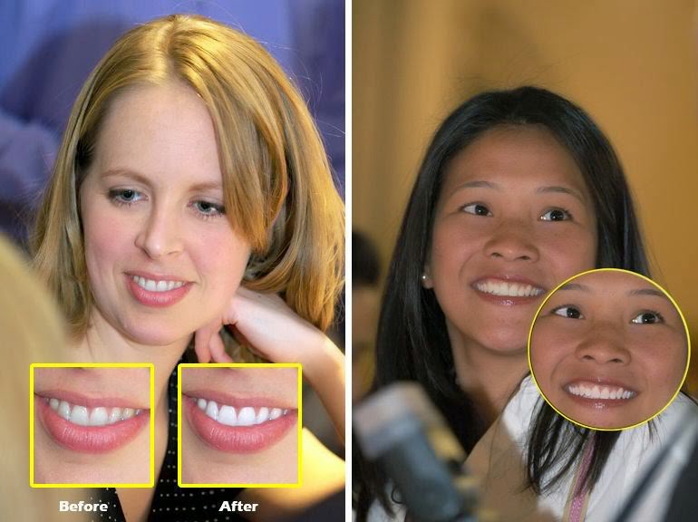 Image trends shineoff 2.1.4 and pearly whites 2.1.3 photoshop plugins chingliu