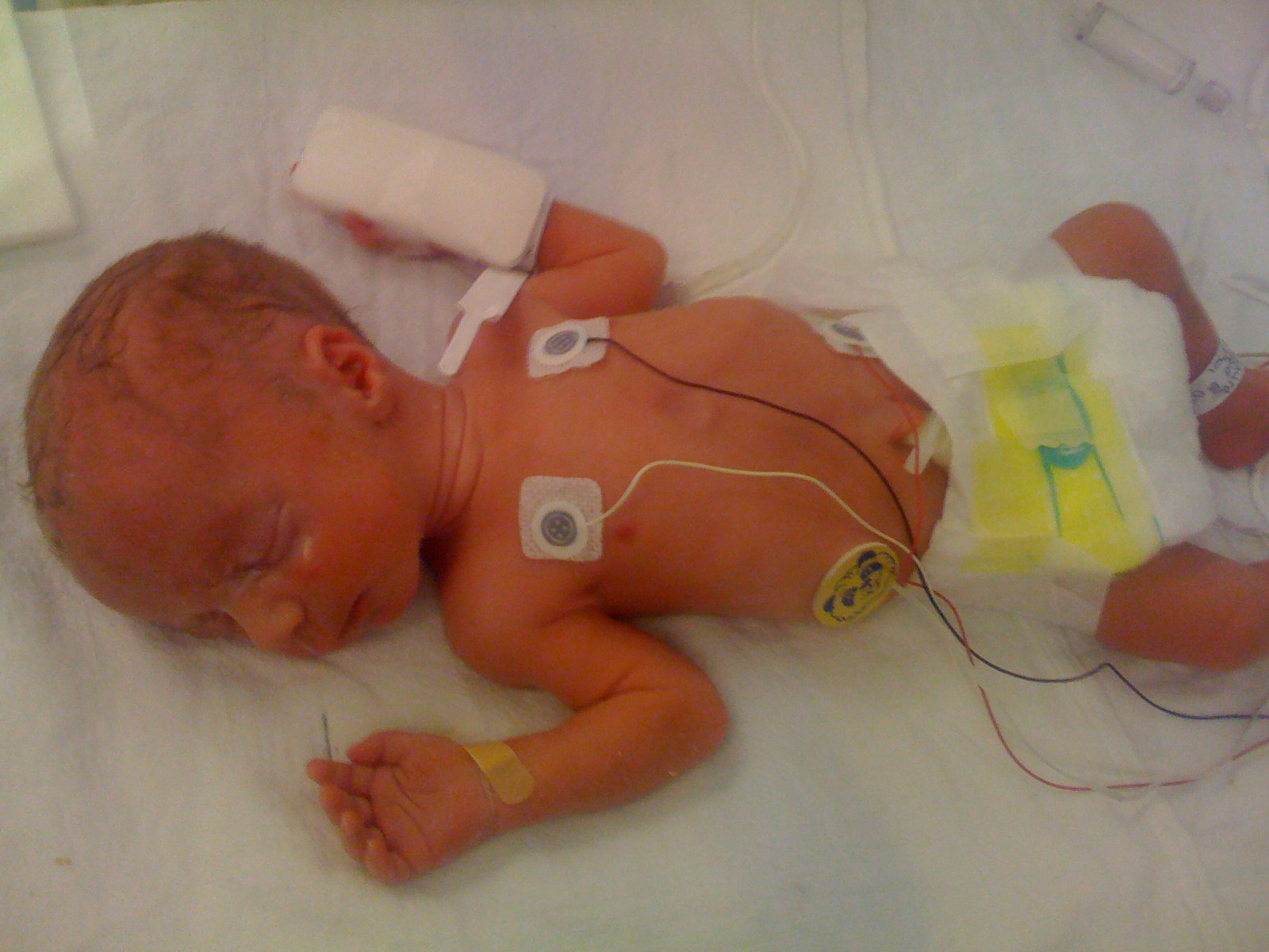 5 Strands of Hope Smoking's Bad Article about risks to Unborn Babies