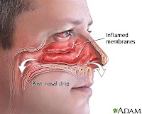 anatomi hidung anatomi hidung