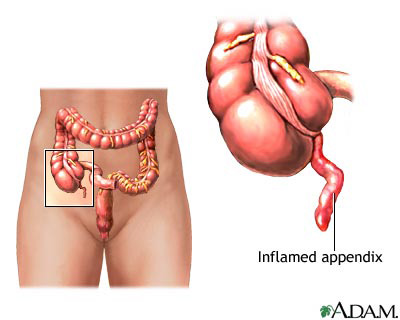 appendix women