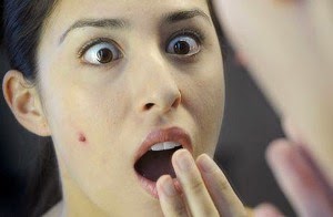 7 Jenis Minyak Zaitun Untuk Menghilangkan Jerawat