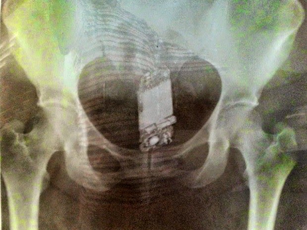 masturbando se sexo no hospital masturbando se sexo no hospital
