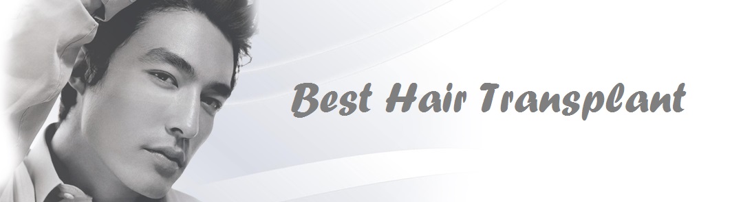 Best Hair Transplant NYC - Revive FUE Hair Restoration