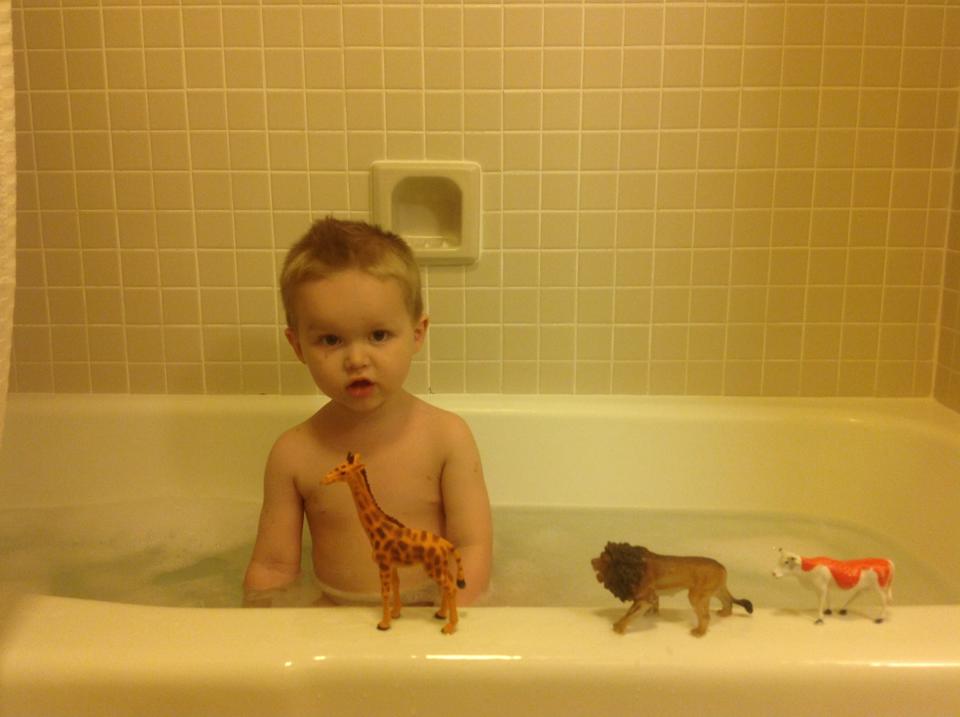 Brayden's Journey Sucessful surgery 8! And before and after pictures!!