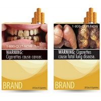 Neurofeedback Nedir Nasil Yapilir Trt Haber Youtube