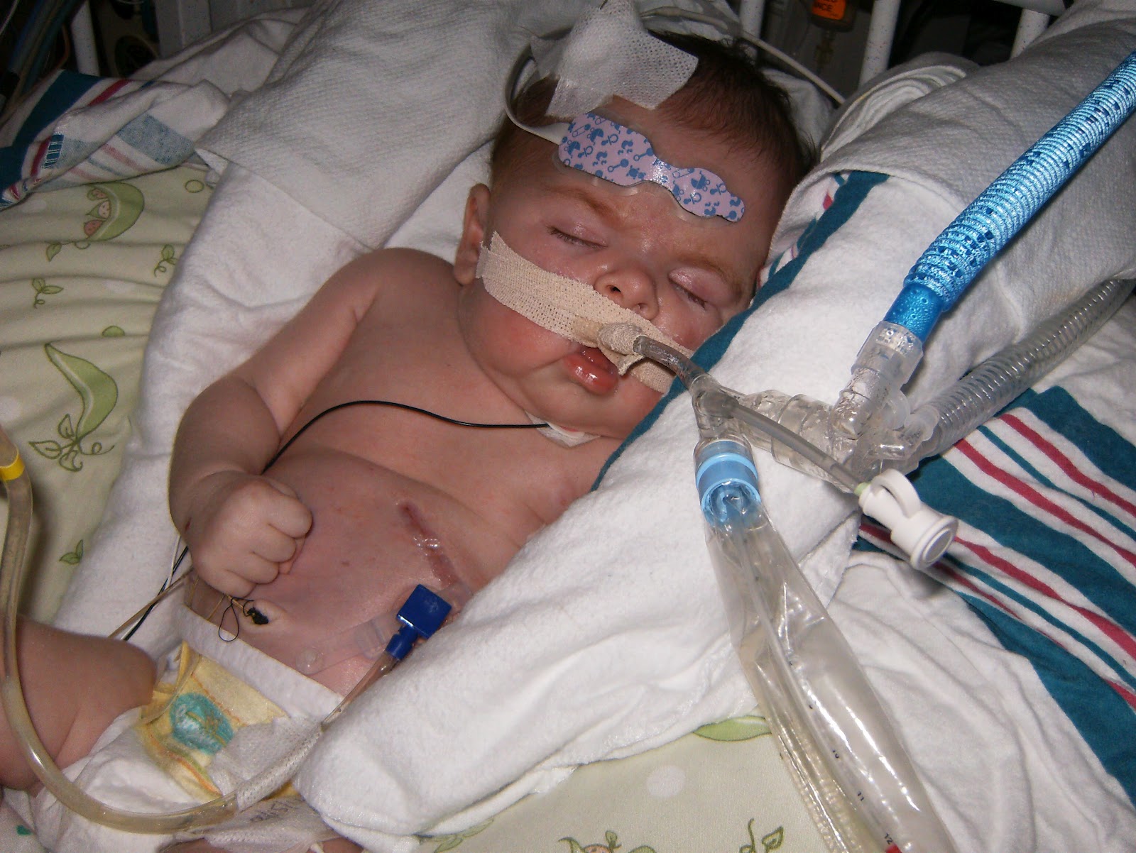 Anya Mae's Story: August 2012