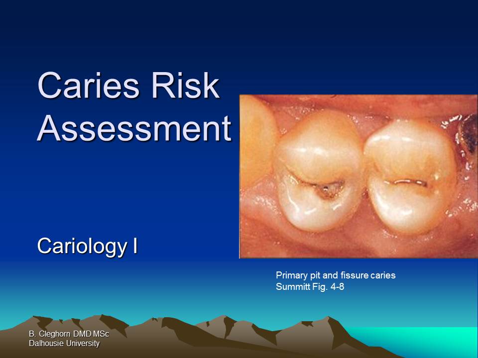 Dentistry Caries Risk Assessment
