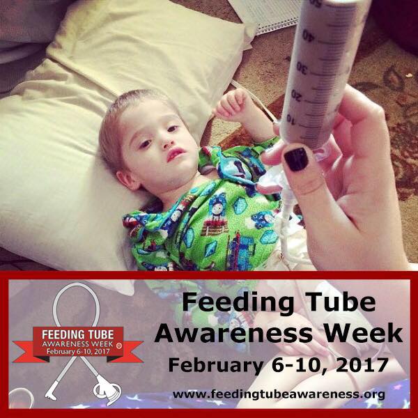 #feedingtubeawareness