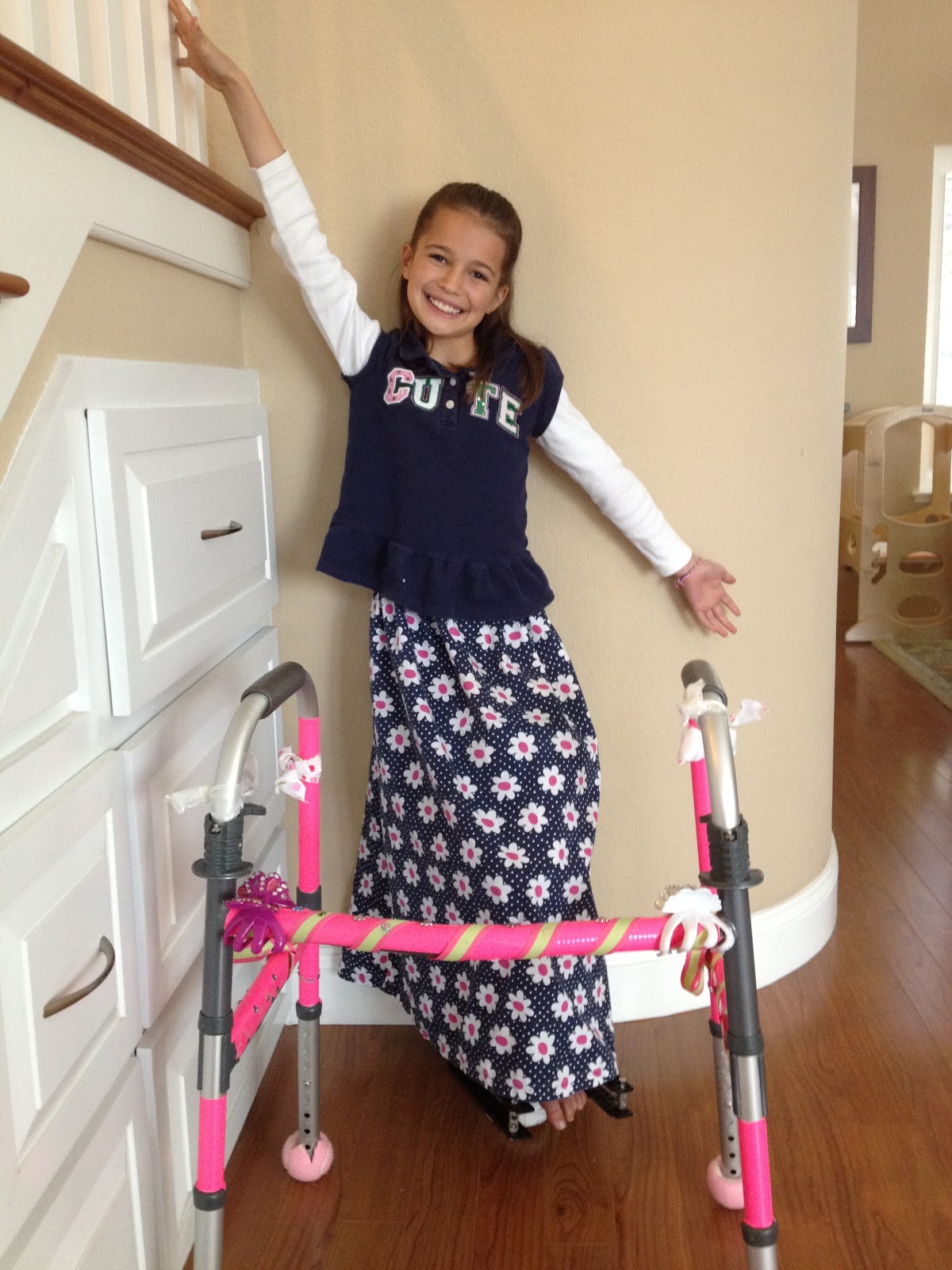 fibular hemimelia leg lengthening Decorated Walker