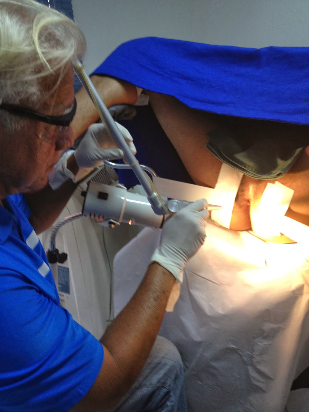 Blog do Saúde Médica Cirurgia da hemorroida Laser com ligadura