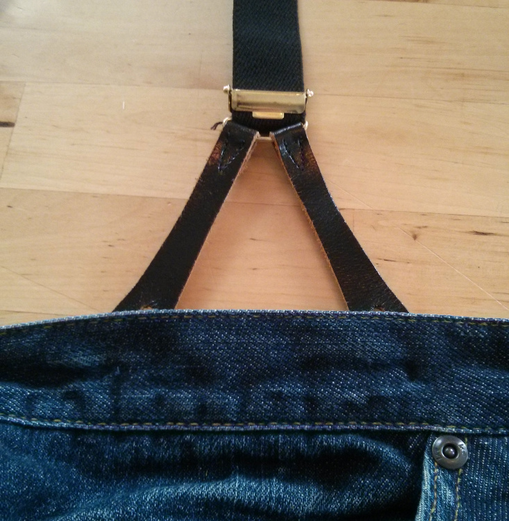 Everything About Braces How to sew on Brace Buttons