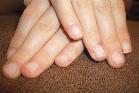 How to soften nails for cutting Scratch My Back Nail Studio: Fast Fixes for Natural Nails