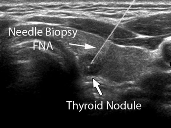 Che Esami Si Sballano In Caso Tumori Discount