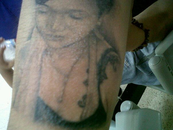 Tattoo Shops In The Philippines: Wierd skin rash, blemishes, bumps on a  fully healed tattoo
